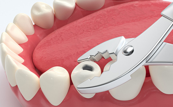 合肥种植牙医院排名总榜(2025)发布-老人能种植牙吗(图1) yczl76.jpg