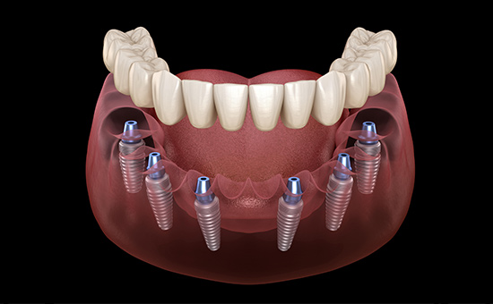 合肥种植牙专科医院排行榜「前十排名公布」老年人种植牙多少钱(图1) zzy45.jpg